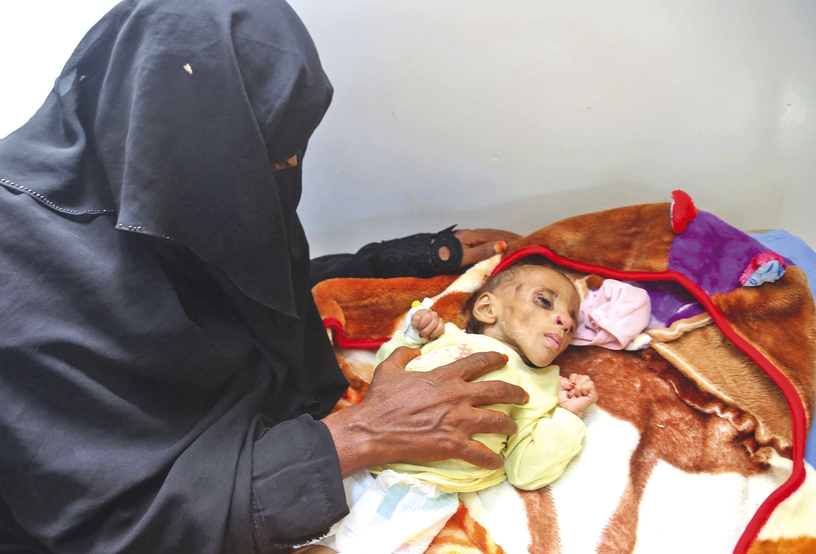 Dans la ville portuaire de Hodeidah, mardi, une femme s’occupe de son bébé qui souffre de malnutitrition.
