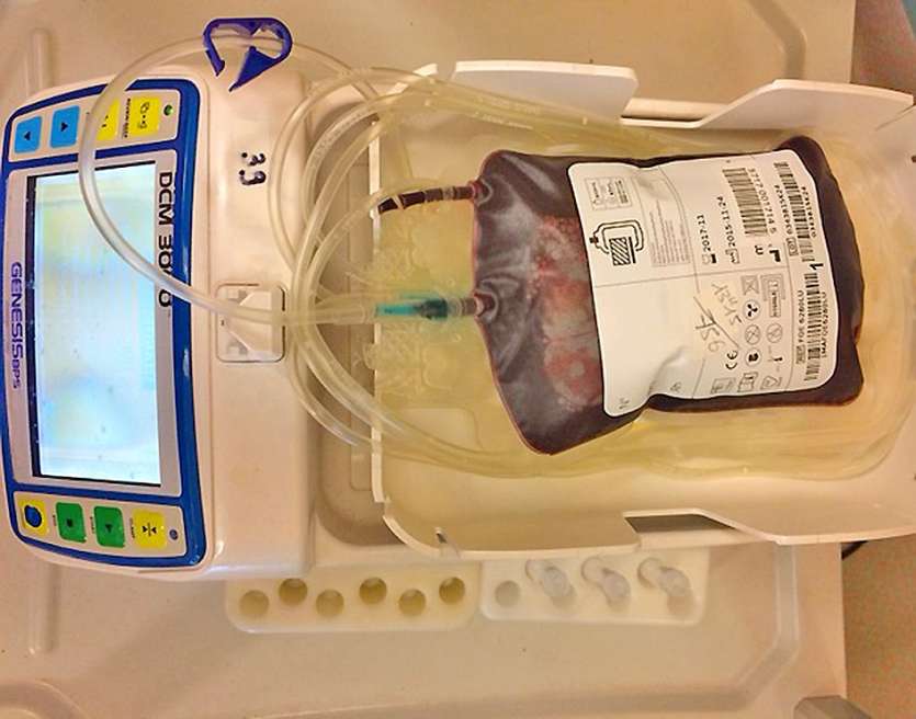 36 poches de sang de 400 ml ont été collectées hier chez Caltrac. Elles pourront être utilisées pendant une durée maximale de 42 jours.