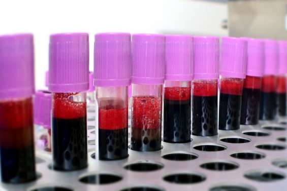 Les sangs rares, marqueurs méconnus de la diversité humaine