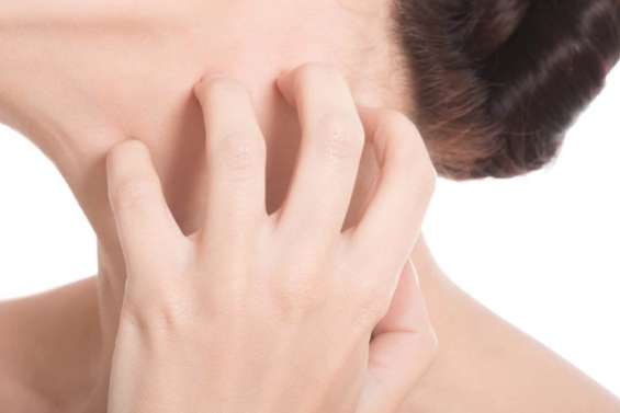 Avec la chaleur, attention à la gale