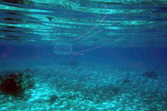 Les méduses sont davantage présentes, quels sont les bons gestes à adopter ?