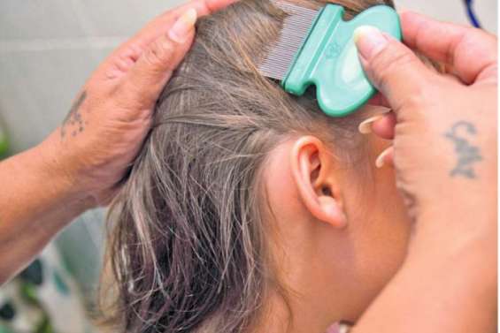 Comment (bien) faire la guerre aux poux