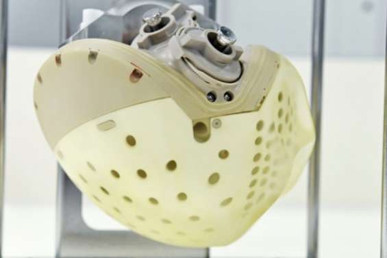 Carmat vend son cœur pour la première fois