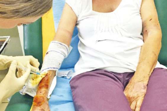 Attaque de chiens à Bourail : amende avec sursis pour les propriétaires