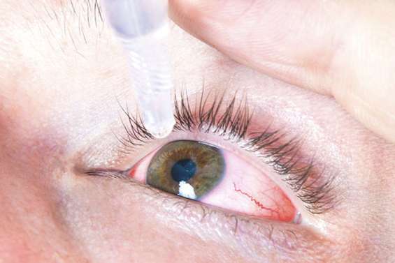 Attention les yeux : début d’épidémie de conjonctivite