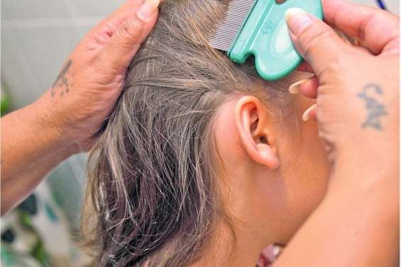 Le casse-tête des produits anti-poux