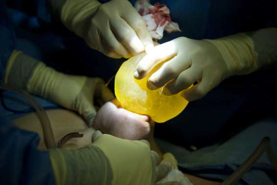 Prothèses PIP : remboursement élargi 