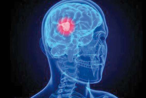 Epidémie de traumatisme