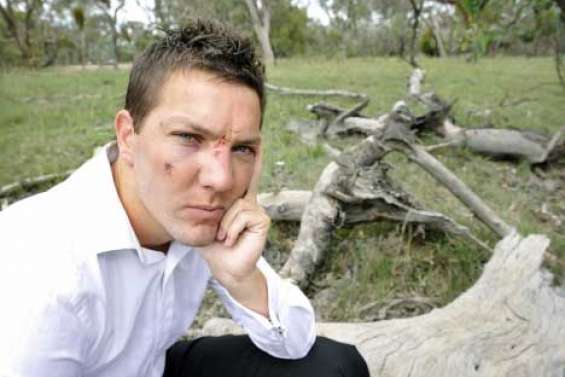 Mis K.-O. par un kangourou