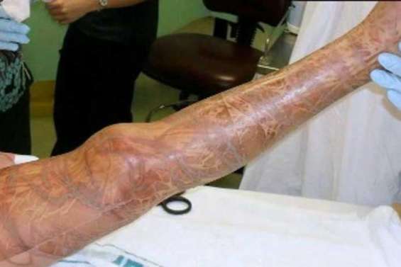 Une jeune Australienne survit à une piqûre mortelle de méduse