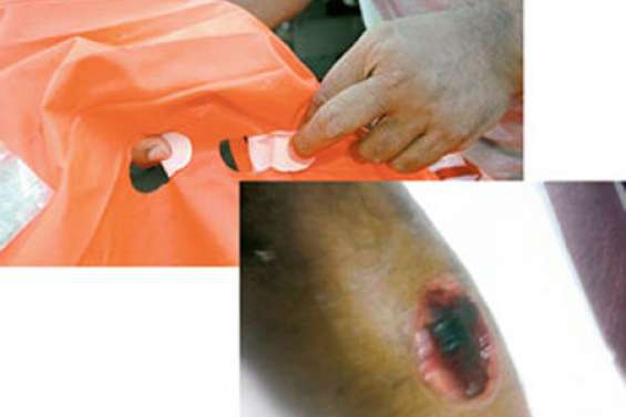 L'incroyable récit de l'attaque des calmars