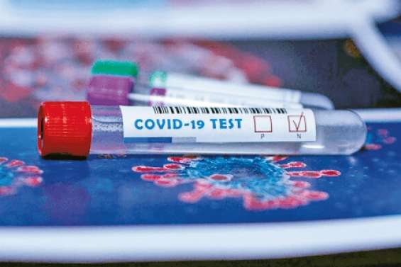 Des chercheurs espèrent pouvoir produire 100 millions de vaccins d’ici la fin de l’année prochaine